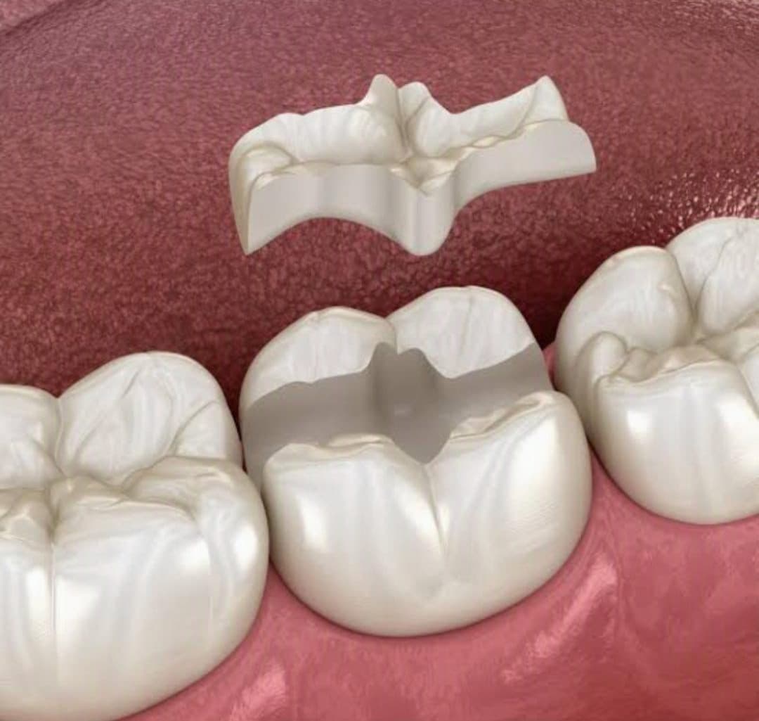 Rehabilitación Oral